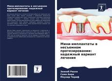 Borítókép a  Мини-имплантаты в несъемном протезировании: надежный вариант лечения - hoz