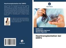 Capa do livro de Haartransplantation bei OMFS 