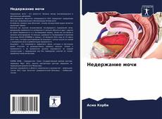 Недержание мочи的封面
