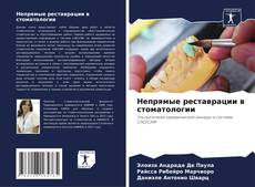 Bookcover of Непрямые реставрации в стоматологии