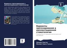 Bookcover of Варианты протезирования в имплантационной стоматологии