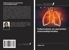 Copertina di Tuberculosis en pacientes inmunodeprimidos