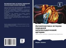 Ангиопластика остиума передней межжелудочковой артерии的封面