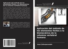 Copertina di Aplicación del método de los elementos finitos a la biomecánica de la columna vertebral humana