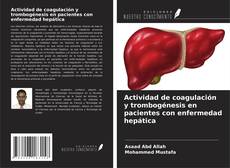 Couverture de Actividad de coagulación y trombogénesis en pacientes con enfermedad hepática