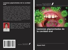 Buchcover von Lesiones pigmentadas de la cavidad oral