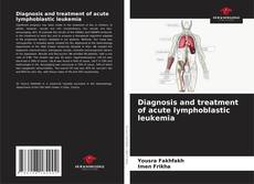 Bookcover of Diagnosis and treatment of acute lymphoblastic leukemia