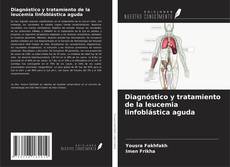 Buchcover von Diagnóstico y tratamiento de la leucemia linfoblástica aguda