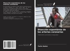 Borítókép a  Disección espontánea de las arterias coronarias - hoz