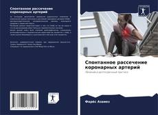 Спонтанное рассечение коронарных артерий的封面