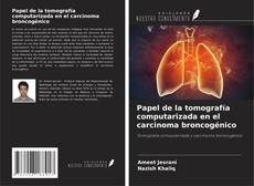 Copertina di Papel de la tomografía computarizada en el carcinoma broncogénico