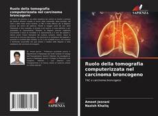 Buchcover von Ruolo della tomografia computerizzata nel carcinoma broncogeno