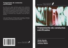 Buchcover von Tratamiento de conductos calcificados