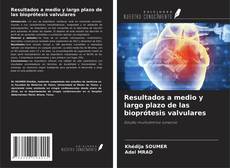Buchcover von Resultados a medio y largo plazo de las bioprótesis valvulares