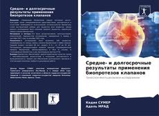 Capa do livro de Средне- и долгосрочные результаты применения биопротезов клапанов 