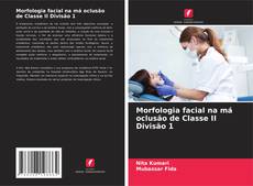 Buchcover von Morfologia facial na má oclusão de Classe II Divisão 1