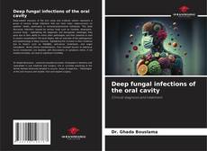 Buchcover von Deep fungal infections of the oral cavity