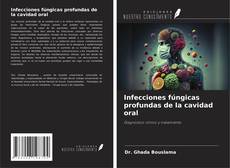 Buchcover von Infecciones fúngicas profundas de la cavidad oral