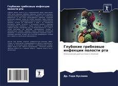 Capa do livro de Глубокие грибковые инфекции полости рта 