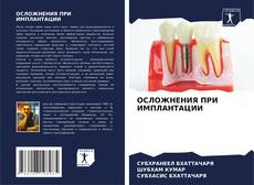 ОСЛОЖНЕНИЯ ПРИ ИМПЛАНТАЦИИ的封面