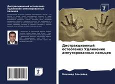 Обложка Дистракционный остеогенез Удлинение ампутированных пальцев