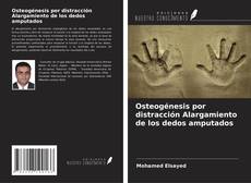 Copertina di Osteogénesis por distracción Alargamiento de los dedos amputados