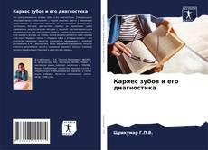 Capa do livro de Кариес зубов и его диагностика 