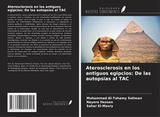 Buchcover von Aterosclerosis en los antiguos egipcios: De las autopsias al TAC