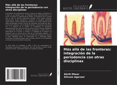 Buchcover von Más allá de las fronteras: Integración de la periodoncia con otras disciplinas