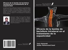 Copertina di Eficacia de la bomba de baclofeno intratecal en el tratamiento de la espasticidad