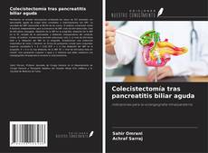 Capa do livro de Colecistectomía tras pancreatitis biliar aguda 