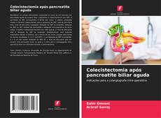 Buchcover von Colecistectomia após pancreatite biliar aguda