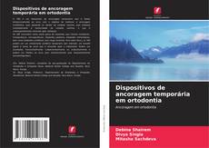 Buchcover von Dispositivos de ancoragem temporária em ortodontia