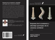 Buchcover von Esquema de la anatomía y abordaje quirúrgico de la columna vertebral