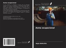 Copertina di Asma ocupacional