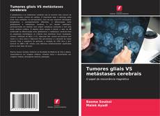 Buchcover von Tumores gliais VS metástases cerebrais