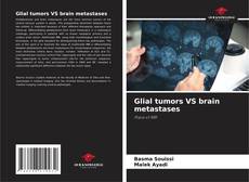 Buchcover von Glial tumors VS brain metastases