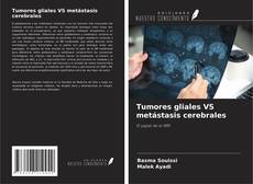 Copertina di Tumores gliales VS metástasis cerebrales