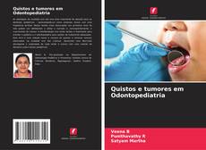 Buchcover von Quistos e tumores em Odontopediatria