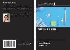 Buchcover von Control de placa