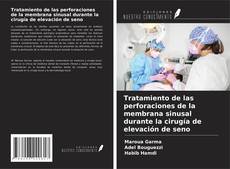 Copertina di Tratamiento de las perforaciones de la membrana sinusal durante la cirugía de elevación de seno
