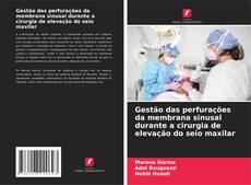 Buchcover von Gestão das perfurações da membrana sinusal durante a cirurgia de elevação do seio maxilar