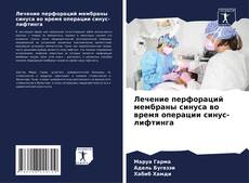 Couverture de Лечение перфораций мембраны синуса во время операции синус-лифтинга