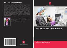 Buchcover von PILARES EM IMPLANTES