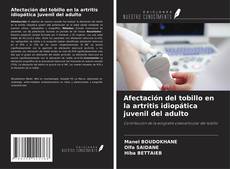 Buchcover von Afectación del tobillo en la artritis idiopática juvenil del adulto