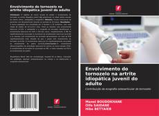 Buchcover von Envolvimento do tornozelo na artrite idiopática juvenil do adulto