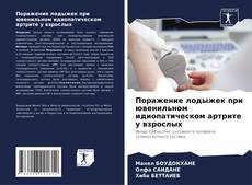 Couverture de Поражение лодыжек при ювенильном идиопатическом артрите у взрослых