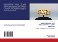 Bookcover of Maxillectomy and Reconstruction with implants