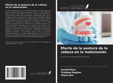 Buchcover von Efecto de la postura de la cabeza en la maloclusión