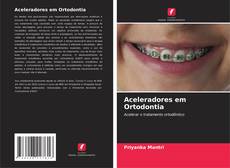 Buchcover von Aceleradores em Ortodontia